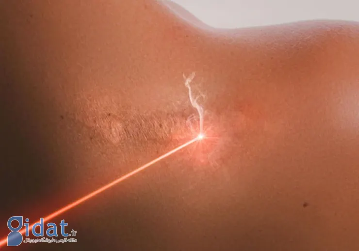 Treatment of boils and scars-4